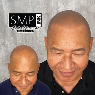 SMP isn’t just for hard young hairlines. This client is in his 60s and wanted to look “natural yet f