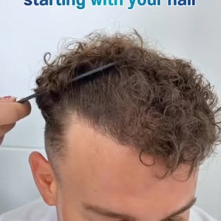 A total transformation starts with your hair👨‍🦱✨
Restore a youthful look and hairline density with