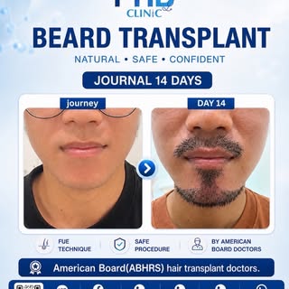 🧔🏻‍♂️ เปลี่ยนลุคใหม่ เพิ่มความมั่นใจให้เกินร้อย! อัปเดตผลลัพธ์หลังปลูกหนวดเพียง 14 วัน 🧔🏻‍♂️

ภา
