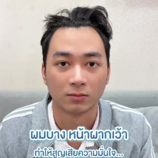 ✨เปลี่ยนความมั่นใจ เริ่มต้นได้ด้วยการปลูกผม 🌱
ออกแบบแนวผมให้เหมาะกับใบหน้า ดูเป็นธรรมชาติทุกมุม

✨N