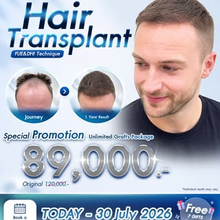 🔥 Special Promotion: Unlimited Grafts Package 🔥
ปลูกแบบไม่จำกัดจำนวนกราฟต์ จัดเต็มให้หนาแน่นสะใจ

