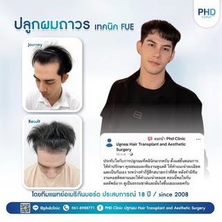 ขอบคุณรีวิวและความไว้วางใจจากคนไข้ทุกท่าน 🙏🏽❤️

จากความกังวลในวันแรก สู่ความมั่นใจในวันนี้ ✨
ผลลัพ