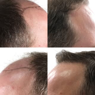 Maxim’s Head of R&D and Director, Joseph, breaks down the connection between bodybuilding and hair l