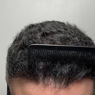 Nothing hits harder than when a client shares their own before-and-after photos in a Google review. 