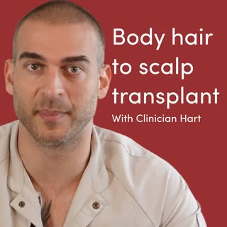 Body-to-scalp hair transplantation is one of the most advanced and technically demanding procedures 