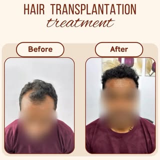 Hair loss doesn’t have to define your confidence. ✨

Every transformation starts with the right diag