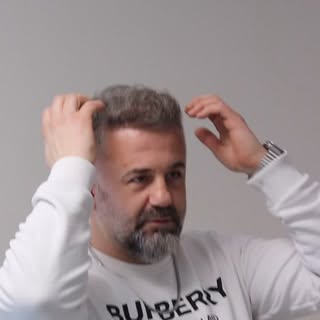 Maksimum sayıda greft ile Samsun’da saç ekimi, saç dökülmesi yaşayan kişilerin en çok araştırdığı ko