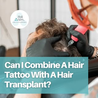 Get the best of both worlds with a hair tattoo and transplant combo! 🏆

There's a lot of uncertaint