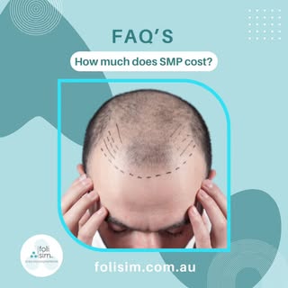 "How much does SMP cost" is often one of the first questions we get, and for good reason.

The cost 