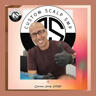 Custom Scalp SMP