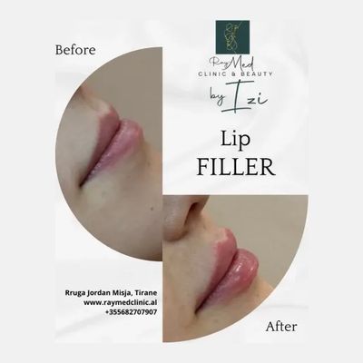 Raymed Clinic & Beauty by IZI