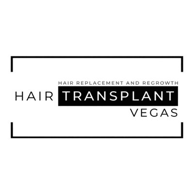 Hair Transplant Vegas