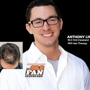 Anthony Lima