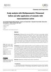 Scalp Analysis with Multiparametric Ultrasound Before and After Application of Cosmetic with Vasoconstrictor Active