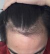 NW1.5 to NW3 in 6 months 17M