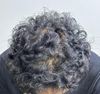 I&rsquo;ve been on Topical Min+Fin for over a year, should I hop on Oral?
