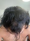 Advice 22 year old male thinning/loss