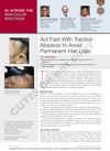 Act Fast With Traction Alopecia To Avoid Permanent Hair Loss