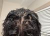 Advice on hair loss