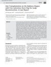 Hair Transplantation on the Baldness Region with Free Latissimus Dorsi Flap for Scalp Reconstruction: A Case Report