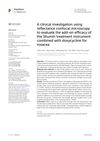 A Clinical Investigation Using Reflectance Confocal Microscopy to Evaluate the Add-On Efficacy of the Shumin Treatment Instrument Combined with Doxycycline for Rosacea