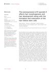 The Overexpression of R-Spondin 3 Affects Hair Morphogenesis and Development Along with the Formation and Maturation of Hair Follicle Stem Cells