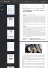 White Hair-Induced Increased Scalp Visibility: Clinical Implications for Hair Loss Evaluation and Hair Transplantation